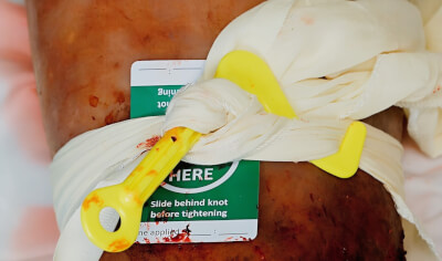 citizenAID Catastrophic Bleeding