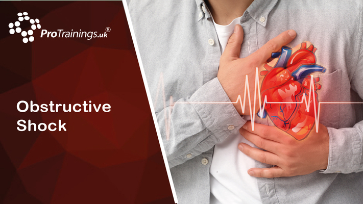 Obstructive Shock 