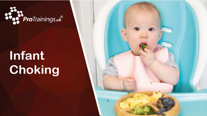 Infant choking 